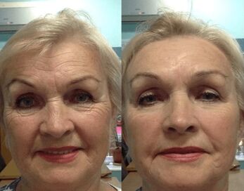 опыт использования крема против морщин Goji Cream - личное фото до и после